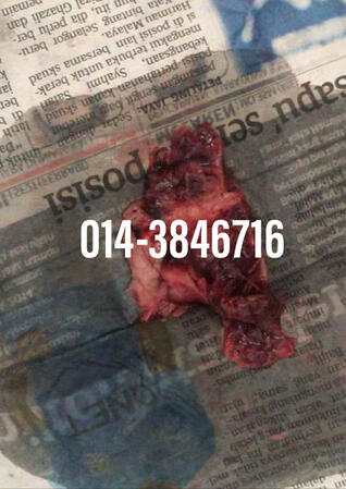 #pil gugur kandungan 1 bulan, #pil gugur kandungan 1 bulan malaysia, #pil gugur kandungan 2 bulan, #pil gugur kandungan 2 bulan malaysia, #pil gugur kandungan 3 bulan malaysia, #pil gugur kandungan 3bulan, #pil gugur kandungan 4 bulan malaysia, #aborsi, #a
