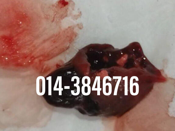 #pil gugur kandungan 1 bulan, #pil gugur kandungan 1 bulan malaysia, #pil gugur kandungan 2 bulan, #pil gugur kandungan 2 bulan malaysia, #pil gugur kandungan 3 bulan malaysia, #pil gugur kandungan 3bulan, #pil gugur kandungan 4 bulan malaysia, #aborsi, #a