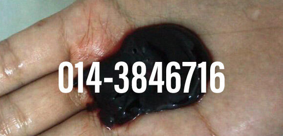 #pil gugur kandungan 1 bulan, #pil gugur kandungan 1 bulan malaysia, #pil gugur kandungan 2 bulan, #pil gugur kandungan 2 bulan malaysia, #pil gugur kandungan 3 bulan malaysia, #pil gugur kandungan 3bulan, #pil gugur kandungan 4 bulan malaysia, #aborsi, #a