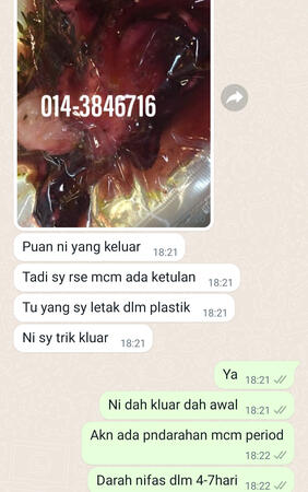 #pil gugur kandungan 1 bulan, #pil gugur kandungan 1 bulan malaysia, #pil gugur kandungan 2 bulan, #pil gugur kandungan 2 bulan malaysia, #pil gugur kandungan 3 bulan malaysia, #pil gugur kandungan 3bulan, #pil gugur kandungan 4 bulan malaysia, #aborsi, #a