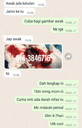 #pil gugur kandungan 1 bulan, #pil gugur kandungan 1 bulan malaysia, #pil gugur kandungan 2 bulan, #pil gugur kandungan 2 bulan malaysia, #pil gugur kandungan 3 bulan malaysia, #pil gugur kandungan 3bulan, #pil gugur kandungan 4 bulan malaysia, #aborsi, #a