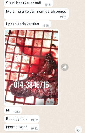 #pil gugur kandungan 1 bulan, #pil gugur kandungan 1 bulan malaysia, #pil gugur kandungan 2 bulan, #pil gugur kandungan 2 bulan malaysia, #pil gugur kandungan 3 bulan malaysia, #pil gugur kandungan 3bulan, #pil gugur kandungan 4 bulan malaysia, #aborsi, #a