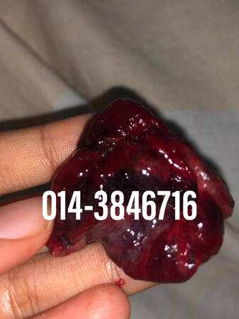 #pil gugur kandungan 1 bulan, #pil gugur kandungan 1 bulan malaysia, #pil gugur kandungan 2 bulan, #pil gugur kandungan 2 bulan malaysia, #pil gugur kandungan 3 bulan malaysia, #pil gugur kandungan 3bulan, #pil gugur kandungan 4 bulan malaysia, #aborsi, #a