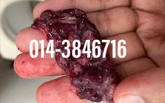 #pil gugur kandungan 1 bulan, #pil gugur kandungan 1 bulan malaysia, #pil gugur kandungan 2 bulan, #pil gugur kandungan 2 bulan malaysia, #pil gugur kandungan 3 bulan malaysia, #pil gugur kandungan 3bulan, #pil gugur kandungan 4 bulan malaysia, #aborsi, #a