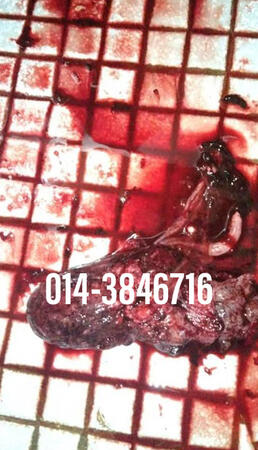 #pil gugur kandungan 1 bulan, #pil gugur kandungan 1 bulan malaysia, #pil gugur kandungan 2 bulan, #pil gugur kandungan 2 bulan malaysia, #pil gugur kandungan 3 bulan malaysia, #pil gugur kandungan 3bulan, #pil gugur kandungan 4 bulan malaysia, #aborsi, #a