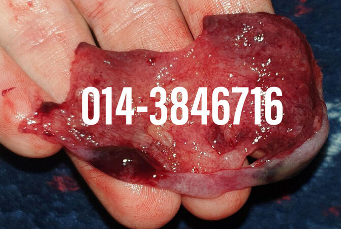#pil gugur kandungan 1 bulan, #pil gugur kandungan 1 bulan malaysia, #pil gugur kandungan 2 bulan, #pil gugur kandungan 2 bulan malaysia, #pil gugur kandungan 3 bulan malaysia, #pil gugur kandungan 3bulan, #pil gugur kandungan 4 bulan malaysia, #aborsi, #a