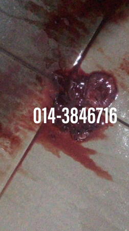 #pil gugur kandungan 1 bulan, #pil gugur kandungan 1 bulan malaysia, #pil gugur kandungan 2 bulan, #pil gugur kandungan 2 bulan malaysia, #pil gugur kandungan 3 bulan malaysia, #pil gugur kandungan 3bulan, #pil gugur kandungan 4 bulan malaysia, #aborsi, #a