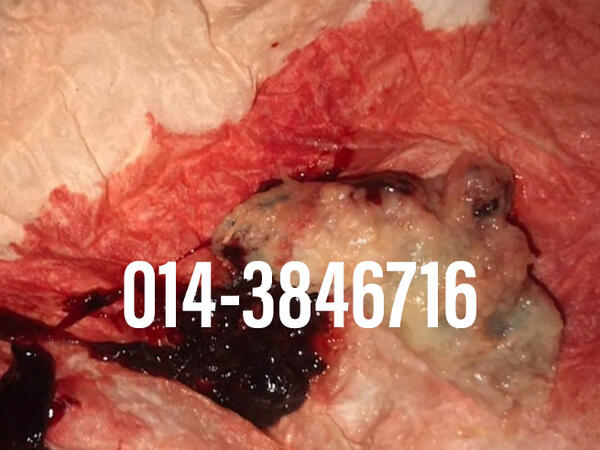 #pil gugur kandungan 1 bulan, #pil gugur kandungan 1 bulan malaysia, #pil gugur kandungan 2 bulan, #pil gugur kandungan 2 bulan malaysia, #pil gugur kandungan 3 bulan malaysia, #pil gugur kandungan 3bulan, #pil gugur kandungan 4 bulan malaysia, #aborsi, #a