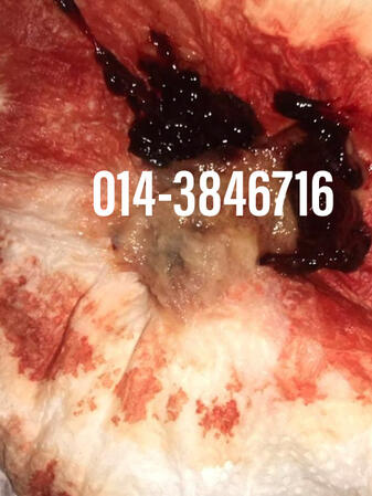 #pil gugur kandungan 1 bulan, #pil gugur kandungan 1 bulan malaysia, #pil gugur kandungan 2 bulan, #pil gugur kandungan 2 bulan malaysia, #pil gugur kandungan 3 bulan malaysia, #pil gugur kandungan 3bulan, #pil gugur kandungan 4 bulan malaysia, #aborsi, #a