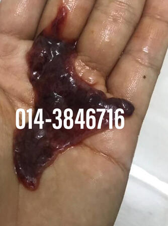 #pil gugur kandungan 1 bulan, #pil gugur kandungan 1 bulan malaysia, #pil gugur kandungan 2 bulan, #pil gugur kandungan 2 bulan malaysia, #pil gugur kandungan 3 bulan malaysia, #pil gugur kandungan 3bulan, #pil gugur kandungan 4 bulan malaysia, #aborsi, #a