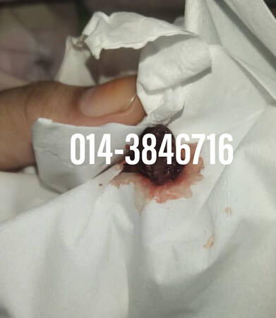 #pil gugur kandungan 1 bulan, #pil gugur kandungan 1 bulan malaysia, #pil gugur kandungan 2 bulan, #pil gugur kandungan 2 bulan malaysia, #pil gugur kandungan 3 bulan malaysia, #pil gugur kandungan 3bulan, #pil gugur kandungan 4 bulan malaysia, #aborsi, #a