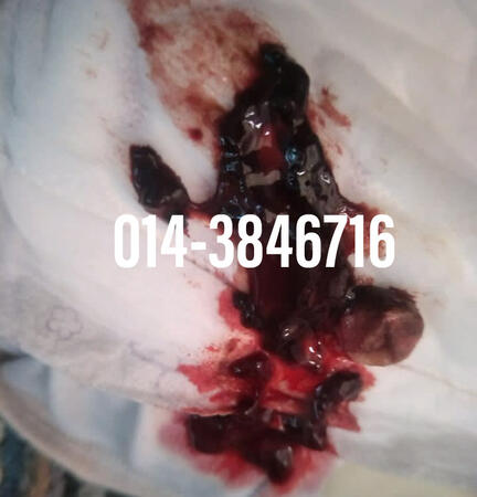 #pil gugur kandungan 1 bulan, #pil gugur kandungan 1 bulan malaysia, #pil gugur kandungan 2 bulan, #pil gugur kandungan 2 bulan malaysia, #pil gugur kandungan 3 bulan malaysia, #pil gugur kandungan 3bulan, #pil gugur kandungan 4 bulan malaysia, #aborsi, #a