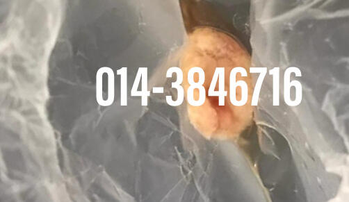 #pil gugur kandungan 1 bulan, #pil gugur kandungan 1 bulan malaysia, #pil gugur kandungan 2 bulan, #pil gugur kandungan 2 bulan malaysia, #pil gugur kandungan 3 bulan malaysia, #pil gugur kandungan 3bulan, #pil gugur kandungan 4 bulan malaysia, #aborsi, #a