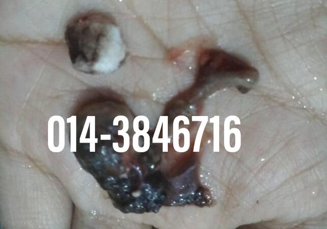#pil gugur kandungan 1 bulan, #pil gugur kandungan 1 bulan malaysia, #pil gugur kandungan 2 bulan, #pil gugur kandungan 2 bulan malaysia, #pil gugur kandungan 3 bulan malaysia, #pil gugur kandungan 3bulan, #pil gugur kandungan 4 bulan malaysia, #aborsi, #a
