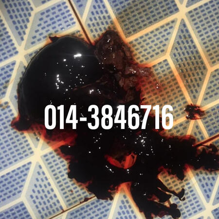 #pil gugur kandungan 1 bulan, #pil gugur kandungan 1 bulan malaysia, #pil gugur kandungan 2 bulan, #pil gugur kandungan 2 bulan malaysia, #pil gugur kandungan 3 bulan malaysia, #pil gugur kandungan 3bulan, #pil gugur kandungan 4 bulan malaysia, #aborsi, #a