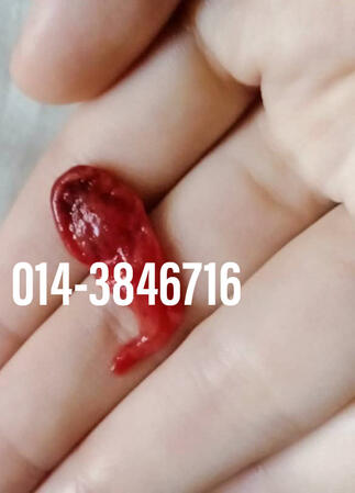 #pil gugur kandungan 1 bulan, #pil gugur kandungan 1 bulan malaysia, #pil gugur kandungan 2 bulan, #pil gugur kandungan 2 bulan malaysia, #pil gugur kandungan 3 bulan malaysia, #pil gugur kandungan 3bulan, #pil gugur kandungan 4 bulan malaysia, #aborsi, #a